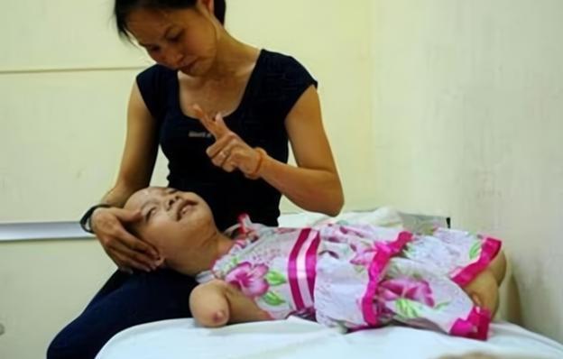 孩子|孕检发现胎儿“没有四肢”,宝妈不顾阻拦坚持生下,如今咋样了