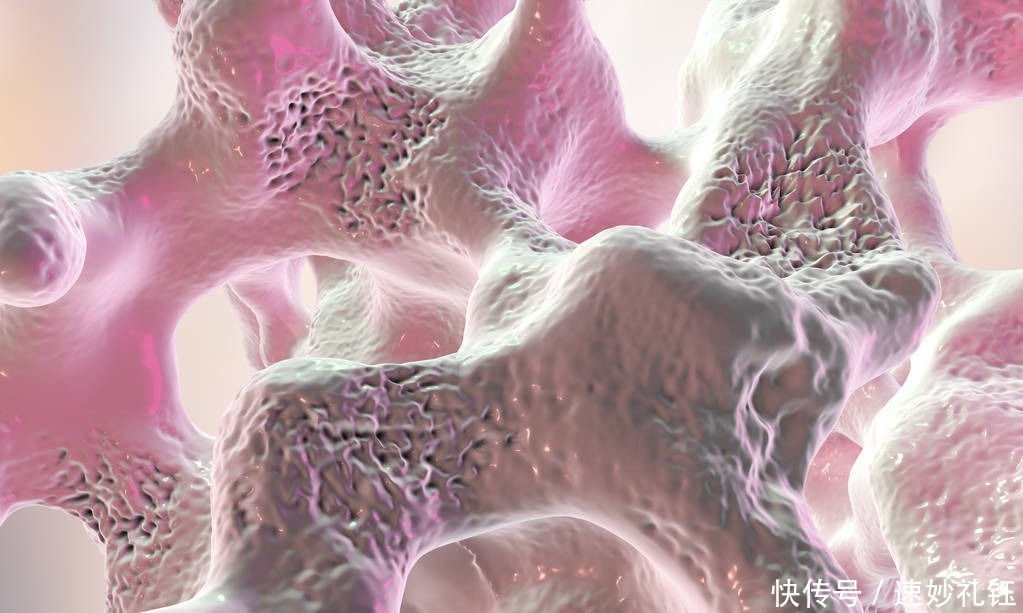 骨科医生|骨科医生：人过60，就怕骨折！吃什么能护骨？不喜欢也要多吃