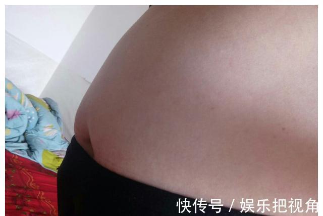 女人|女人如果多次剖腹产,肚子会变成什么样?看完觉得“头皮发麻”