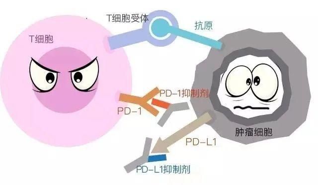  癌细胞|癌细胞“清零”？胃癌晚期的杭州大伯靠这项技术重获新生