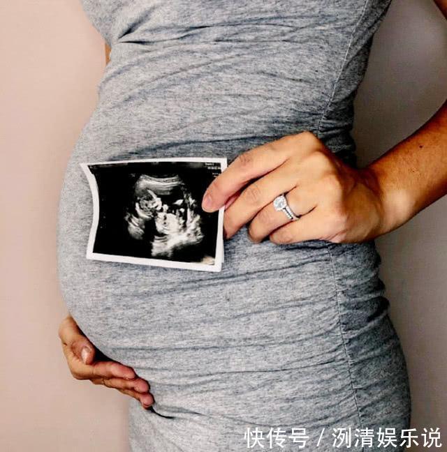 畸形|B超上孩子在做“鬼脸”,宝妈以为是调皮,医生却说孩子要不得