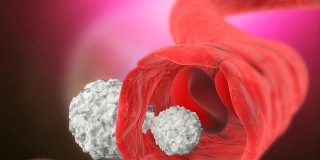 常喝|血脂异常，睡觉可能有5种迹象，常喝2茶，保护血管，降血脂