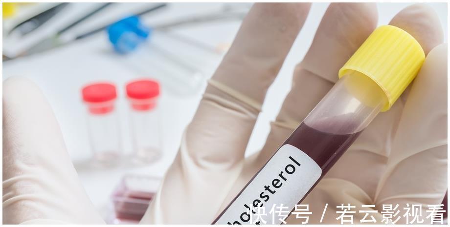 血脂异常|血脂高不高,看脸就知道,若没有这3个症状,恭喜血脂控制得不错