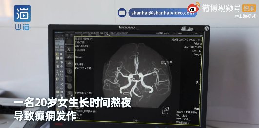 年轻人|20岁女孩熬夜后倒地抽搐!医生:这种病一半是年轻人