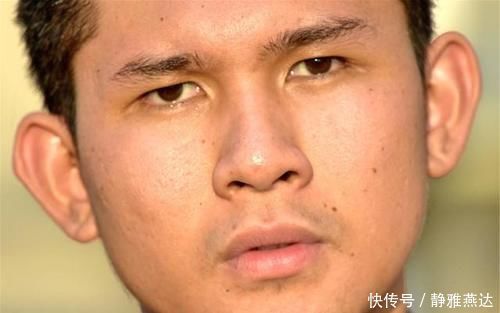 高血糖|糖尿病,最可怕的是并发症!牢记3方法,让血糖高的人远离并发症