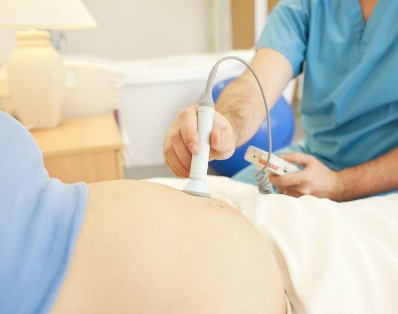 分娩|产妇生娃“姿势”都有哪些“横躺站跪”超乎想象,看你适合哪个