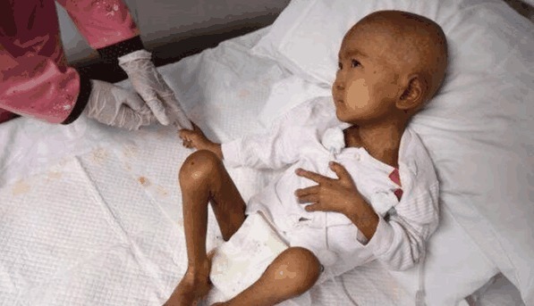 男孩|男孩瘦的只有20斤,母亲却让他禁食,得知真相让人心痛