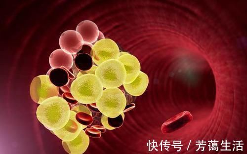 血脂增高|血脂增高不用急,谨记多吃几样食物,血脂可能“悄悄”降下去
