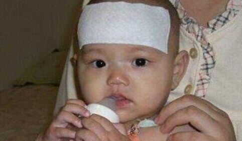 鸡内金|孩子积食再顽固,宝妈用2招,轻松去积食,孩子长大个