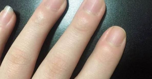 大部分|“月牙”越多，身体越好？大部分人都理解错了，看看自己属于哪种