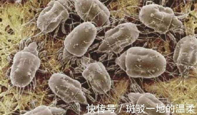 艾草叶|睡觉时感觉身子痒痒的，是什么原因呢，该怎么办？