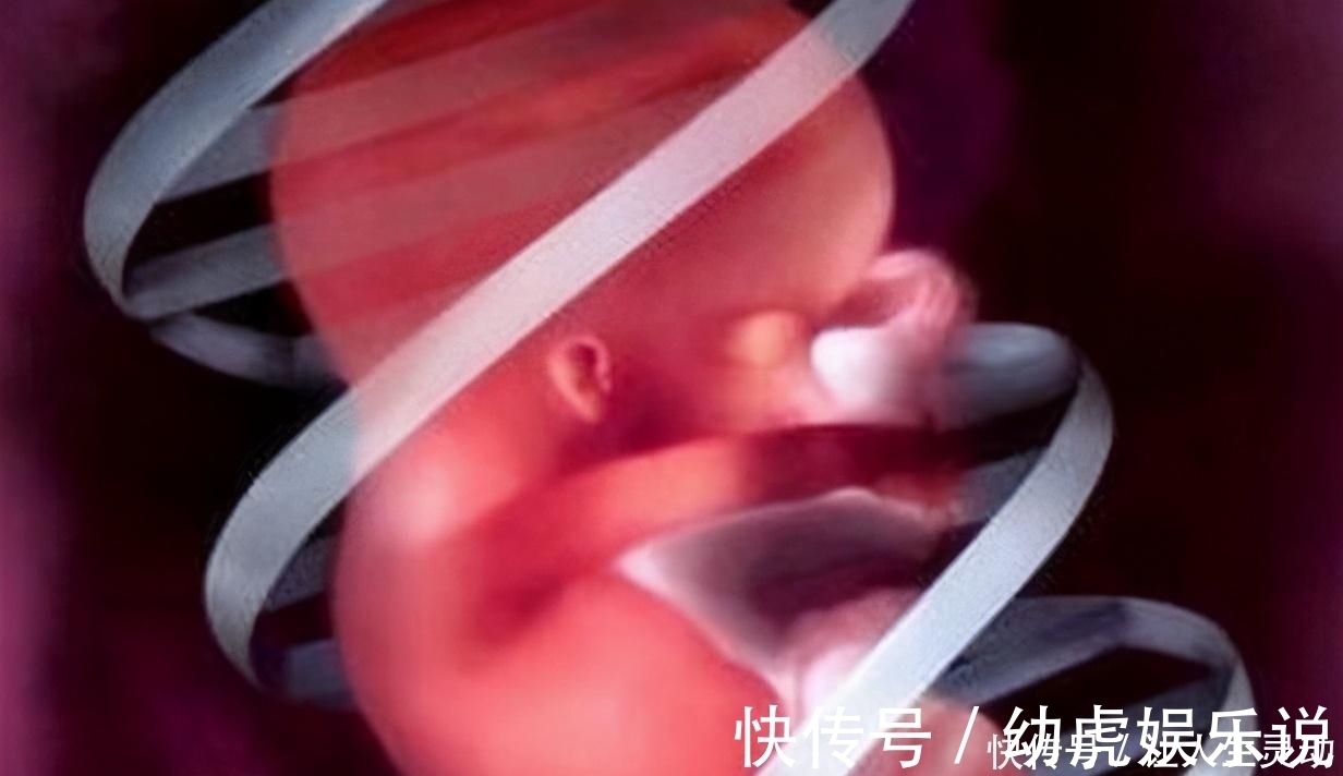 宝宝|胎儿没出生就脐带断裂，医生也无能为力，孕妈抓住宝宝求救信号