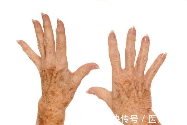 睡眠质量|当衰老来临时,身体或有10个症状,占两个以上,你已步入衰老期