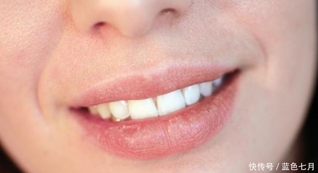 無論男女,如果嘴上出現(xiàn)了“它”,可能是體內(nèi)免疫力要下降了