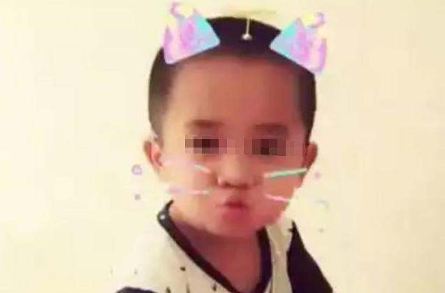 男婴|还记得4年前,因吃奶用力被妈妈用剪刀划花脸的男婴,他现状如何