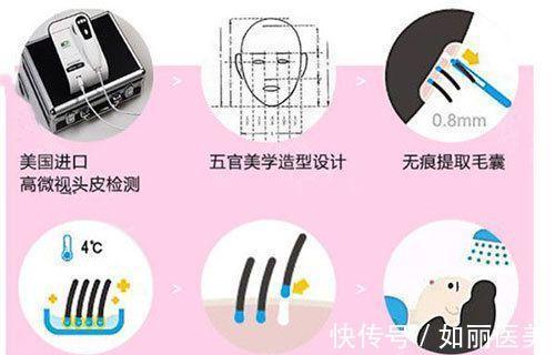 技术 植发技术好不好?植发和微针植发哪个好?优缺点分析