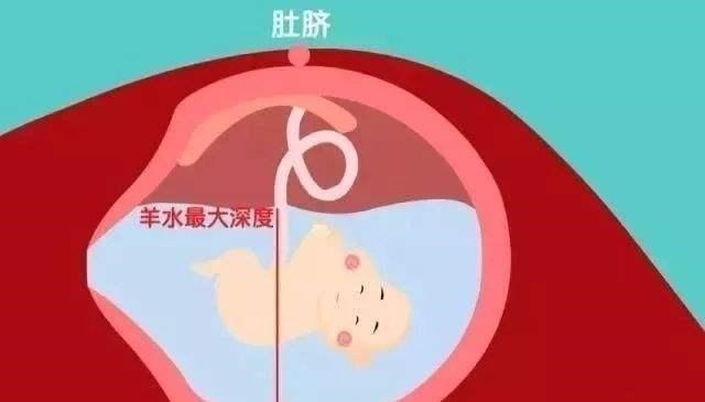羊水量|3类食物会降低羊水质量,影响宝宝发育,这些表现说明羊水好