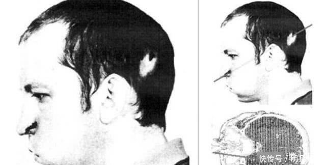 粒子 当他把头伸进粒子加速器时,他被高能质子束直接击中