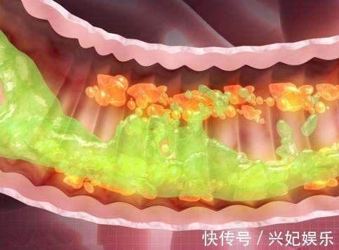 医生|26岁女孩呕吐物呈“粪便样”, 医生无奈救得一时也救不了命