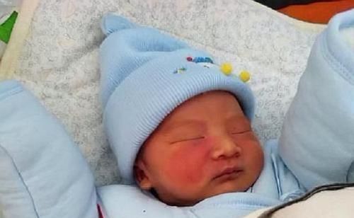 化学物质|胎记是怎么来的?产科大夫:除了遗传,孕期的这3种行为尽量避开