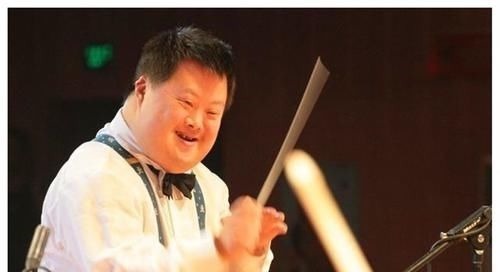 血清标志物|为什么唐氏综合征的人都长着“同一张脸”?唐氏综合征到底是啥?