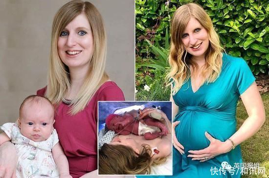 子宫|18岁少女有两个子宫?一月流两次血