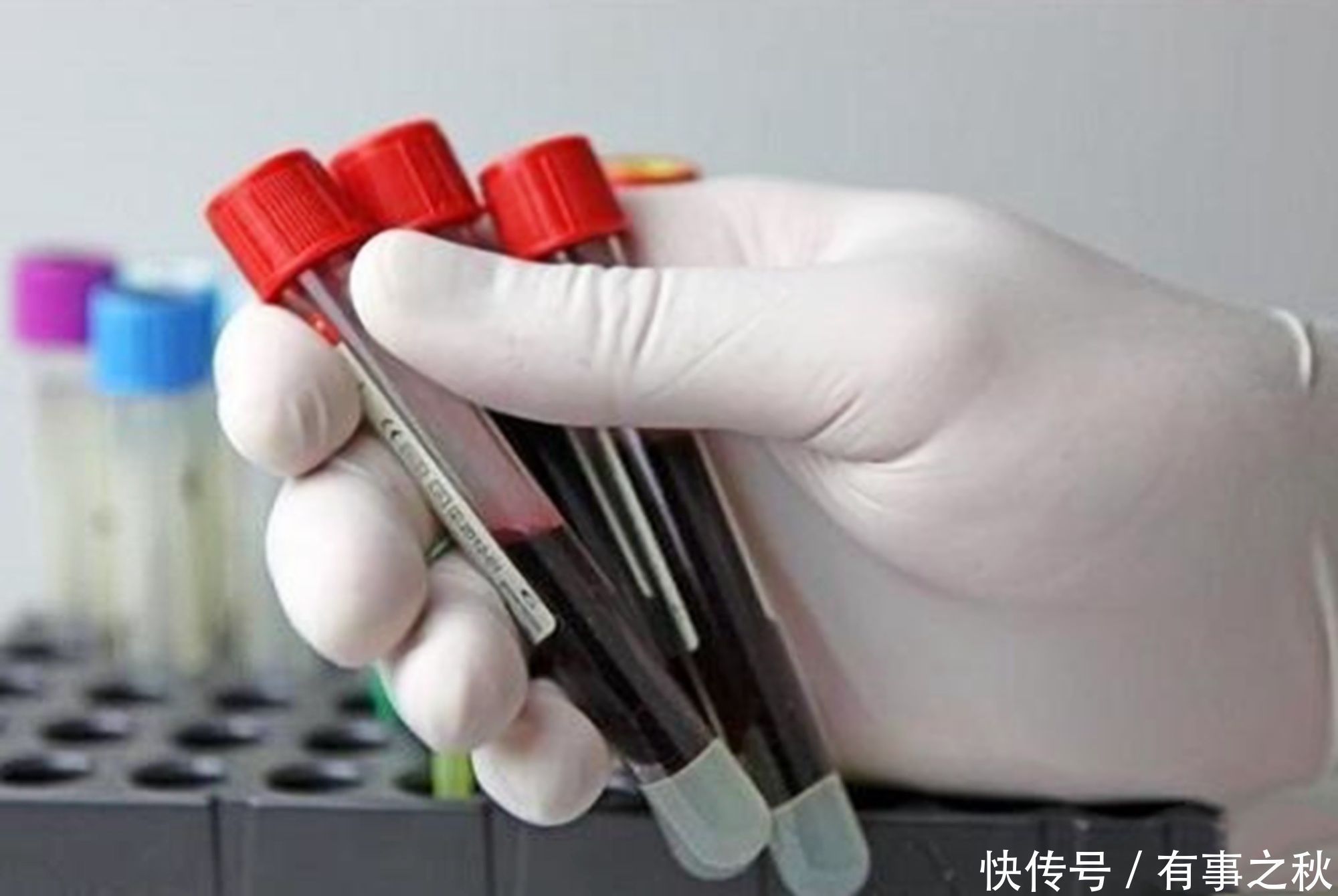 女性|这2种血型的女性,第一胎最好不要流,否则再怀孕风险会成倍增加