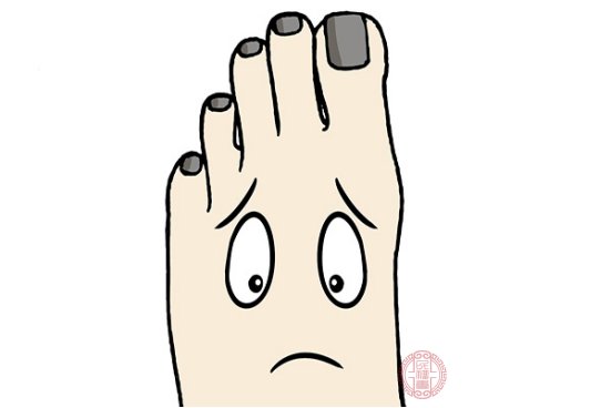灰指甲的治疗方法是什么