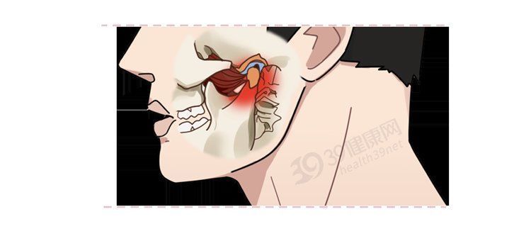 磨牙症|为什么有人总是睡觉磨牙?肚子里真的有蛔虫?科学的解释来了