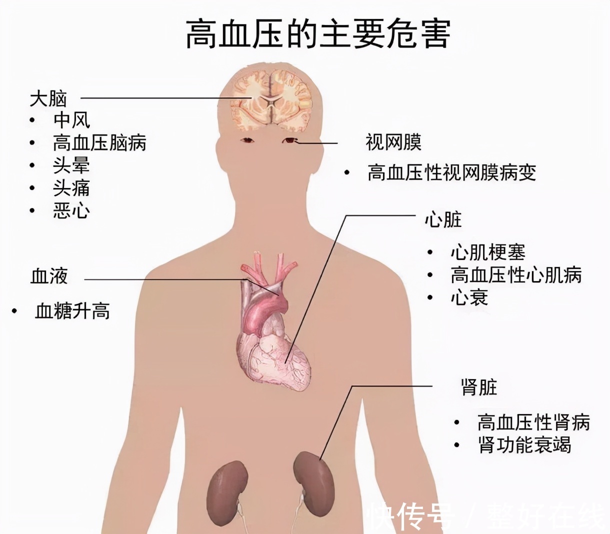 高师傅|高血压=生命的高压线，一旦出现可能危及性命！预防要做好三方面