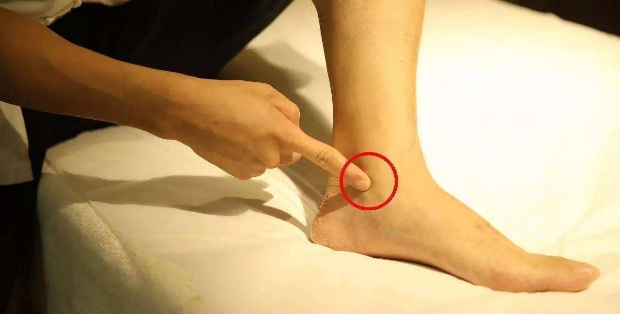 凹陷处|身体出现“痛、麻、冷、酸”,或是经络“堵”了,3个动作能疏通