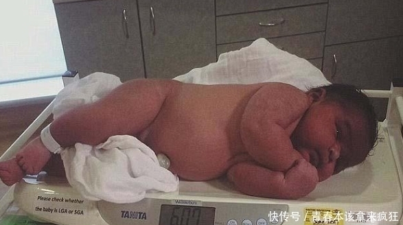 小家伙|小家伙在妈妈肚子里“撑裂”肚皮，医生吓坏差点拒绝接生