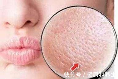 暗沉 秋冬护肤最容易忽略的步骤,少了它,皮肤容易暗沉粗糙、毛孔粗大!