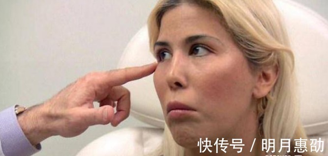 整容手术|女子花重金整容,一年经历13次整容手术,整容前后判若两人