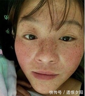 维生素e|药店的小物,每天用些它抹脸,一周斑点全消,皮肤如蛋白般白嫩