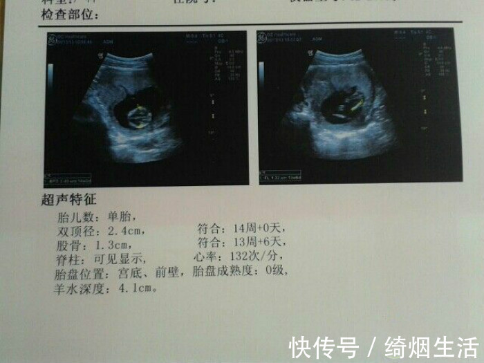 妈妈|怀孕后成功闯关这5次孕检,孕妇可以放宽心了,宝宝会健康到来