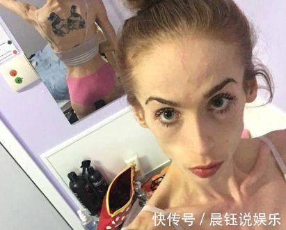 减肥法|女孩为减肥染上厌食症,为当伴娘增肥40斤,出现的时候惊艳全场