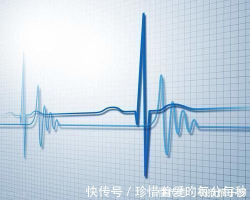 高血压|高血压老人血压波动为哪般?原来是心脏阻滞惹祸端!