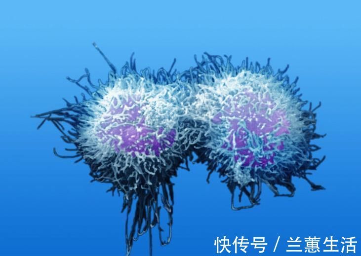 慢性胰腺炎|癌症一发现就是晚期，专家建议，身体的五种小病最好及时治疗