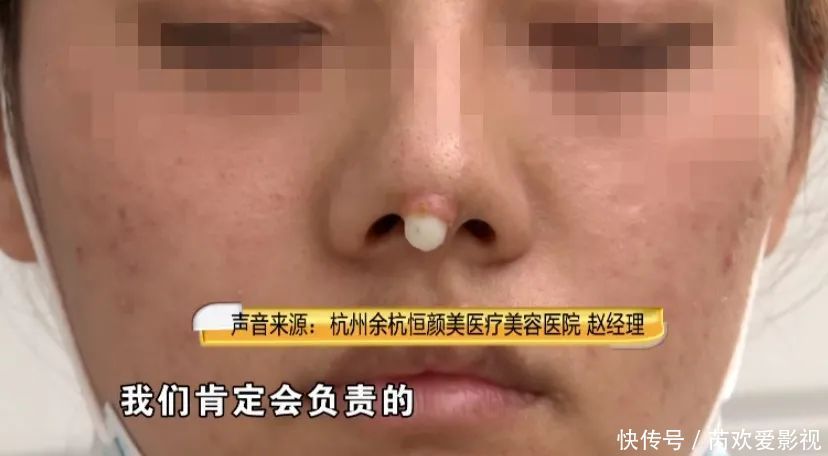 漂亮姑娘刚怀孕，鼻尖出现神秘白色物体！婆婆追问下，她瞒不住了…