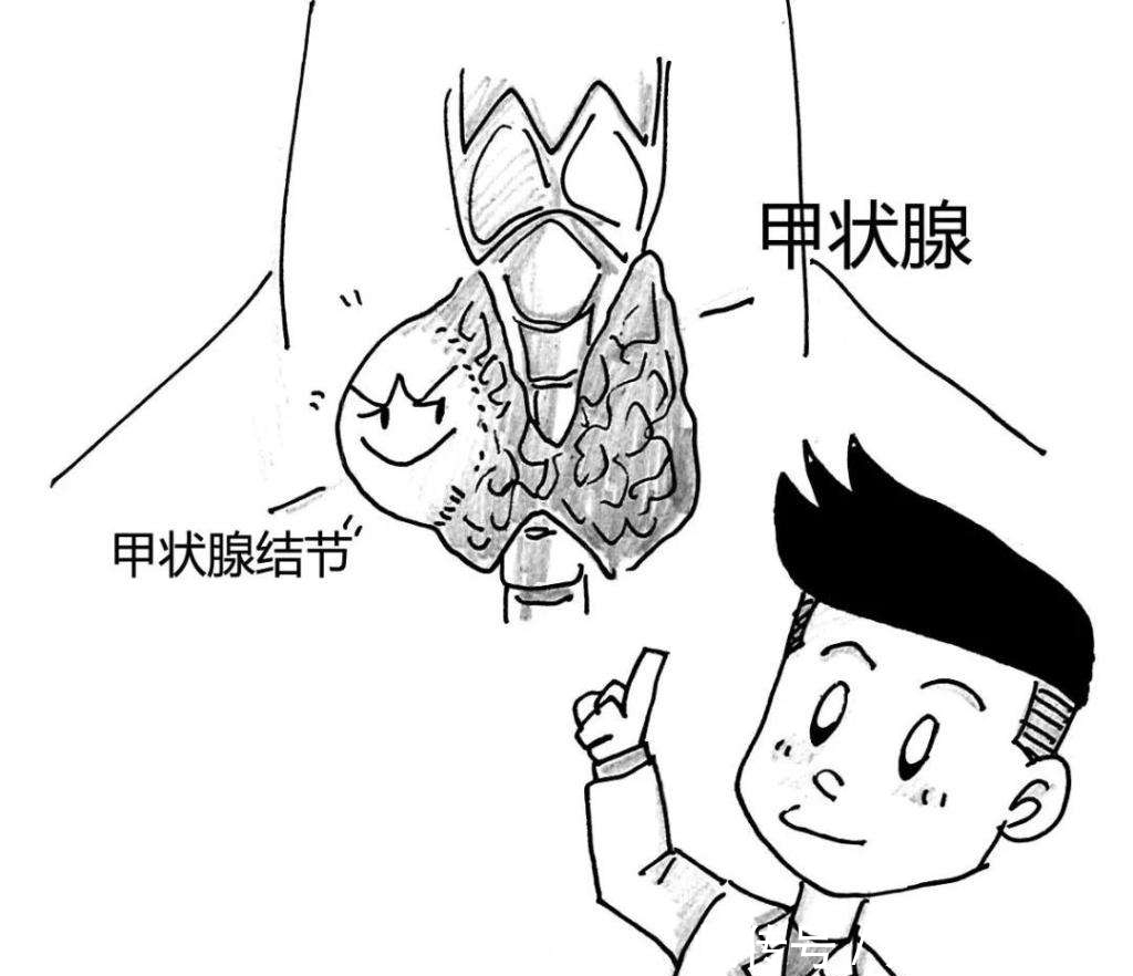 甲状腺结节出现以下一个危险因素即可诊断为甲状腺癌