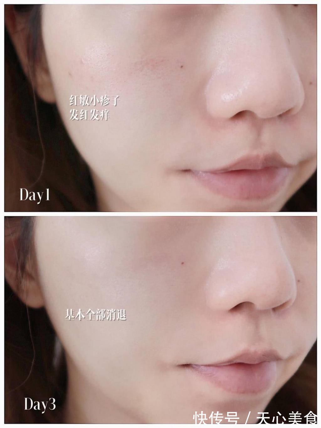 毛孔|美丽零负担,夏日当前,不妨为你的肌肤减减压