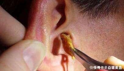 鸡皮疙瘩|7岁男童总说耳朵痒，妈妈用手电筒一看，身上的鸡皮疙瘩都起来了