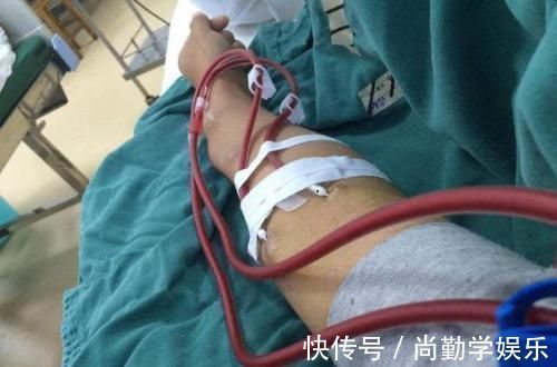 透析|患上尿毒症，还能活多久？医生坦言：三种情况，不容乐观!