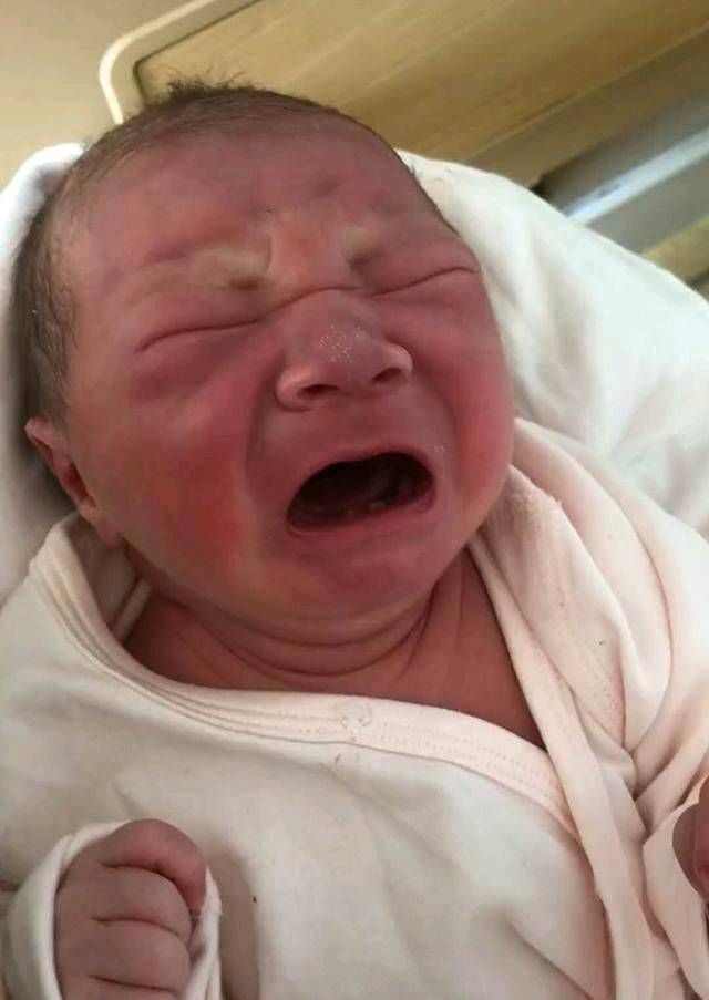 婴儿|这婴儿生下来有两颗牙母亲很自豪,但医生说你的痛苦才刚刚开始