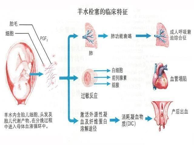 顺产|顺产明明是最高级别的痛，为何妈妈都能撑过去？原来身体如此奇妙