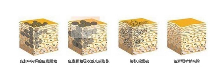 美肤祛斑,无斑时代用妙招还你美丽容颜