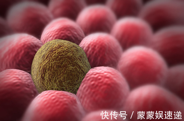 消化科|消化科有慢性胃炎,一个“土方”熬水,养好胃,不复发