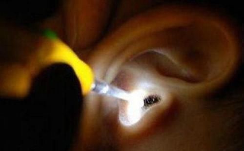 床头|男孩半夜“耳朵疼”,宝妈拿灯一照慌忙送医,这些东西别放床头了