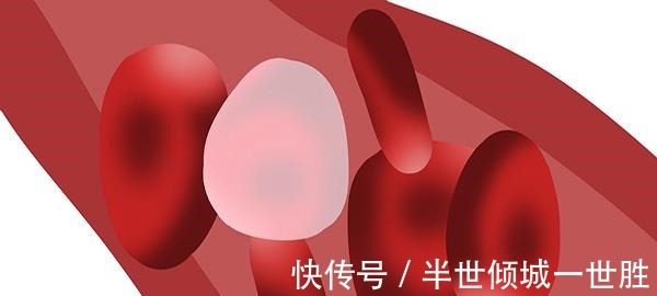 甘油三酯偏高|血脂高先别慌，甘油三脂若没超这个数，做到四点血脂或会恢复正常！